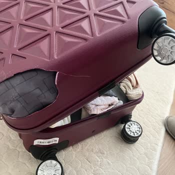 Valiz Hasarı Ve Müşteri Hizmetleri Sorunu