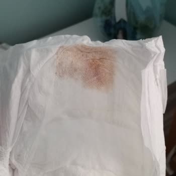 Bebek Bezi Kalitesinde Beklenmedik Sorun