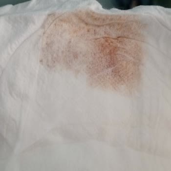 Bebek Bezi Kalitesinde Beklenmedik Sorun