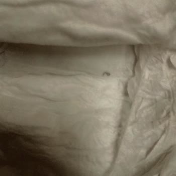 Bebek Bezi İçerisinde Tanımlanamayan Cisimler