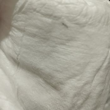 Bebek Bezi İçerisinde Tanımlanamayan Cisimler