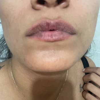 Trendyol Estee Lauder: Hediye Ürünlerin Eşantiyon Olarak Gönderilmesi