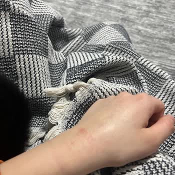 Detergente Fairy causa alergias en la piel.