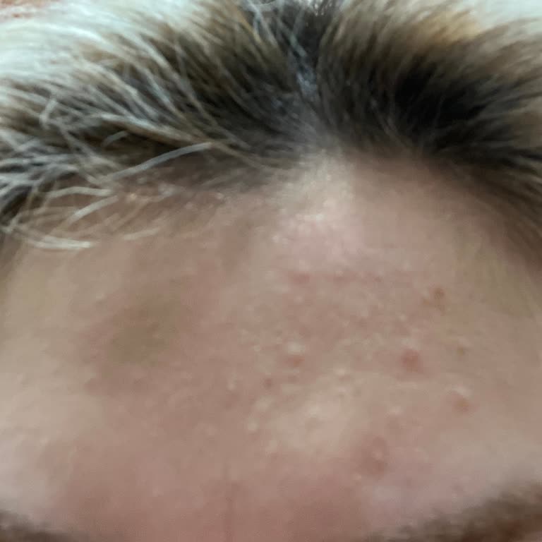 Kötü Kokulu Ve Şüpheli Cilt Bakım Ürünü