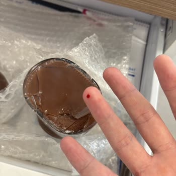 Kırık Nutella Kavanozu: Güvenlik Riski Ve Manevi Zarar