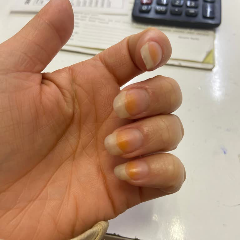 Flormar Oje Sorunu: Beklenmeyen Kalite Problemi