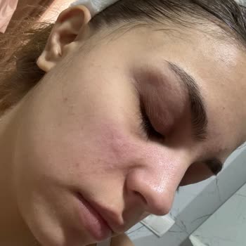 Creamco Ürünleri Cildimi Mahvetti!