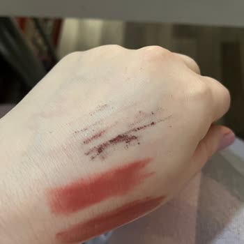 Kuru Göz Kalemi İade Sürecinde Hayal Kırıklığı