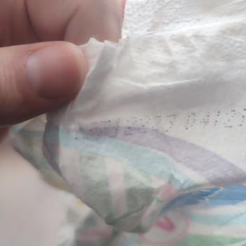 Molfix'in Unuttuğu Emici Katman: Yatak Krizi!
