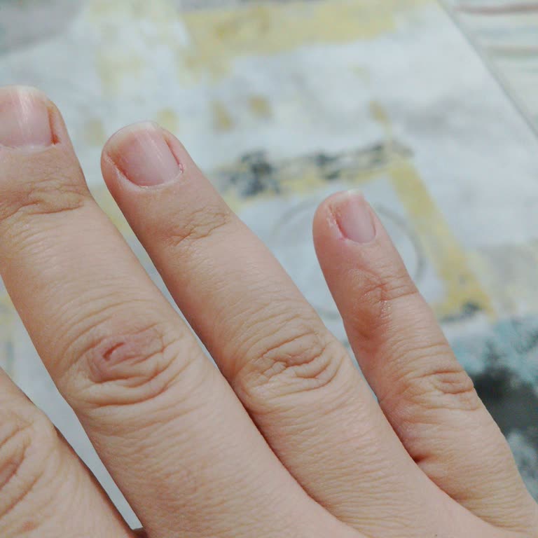 Peros Cilt Sorunları Yaratan Sıvı Sabun!