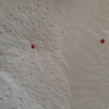 Rota İlaçlama Memnuniyetsizliği