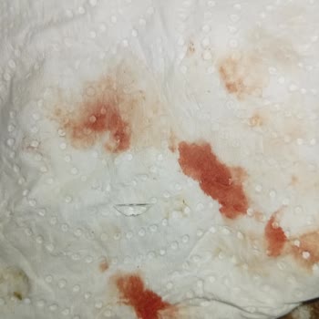 Üründe Cam Parçası Tehlikesi