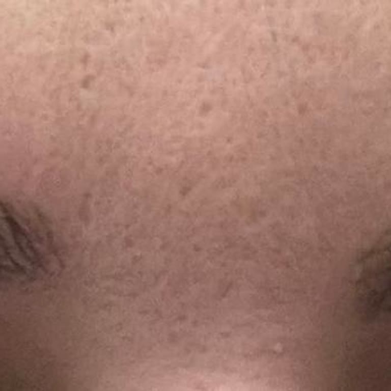 Aris Güzellik Merkezleri Kaş Alımı Fiyaskosu Ve İlgisiz Hizmet