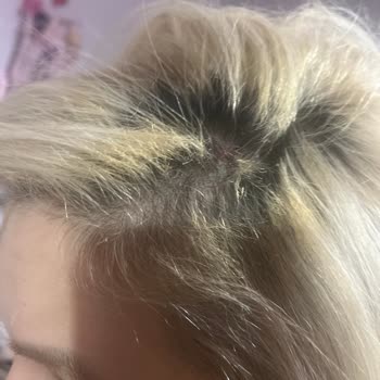 Fantom Jolie Saç Şekillendirici İle Yaşanan Korkunç Deneyim