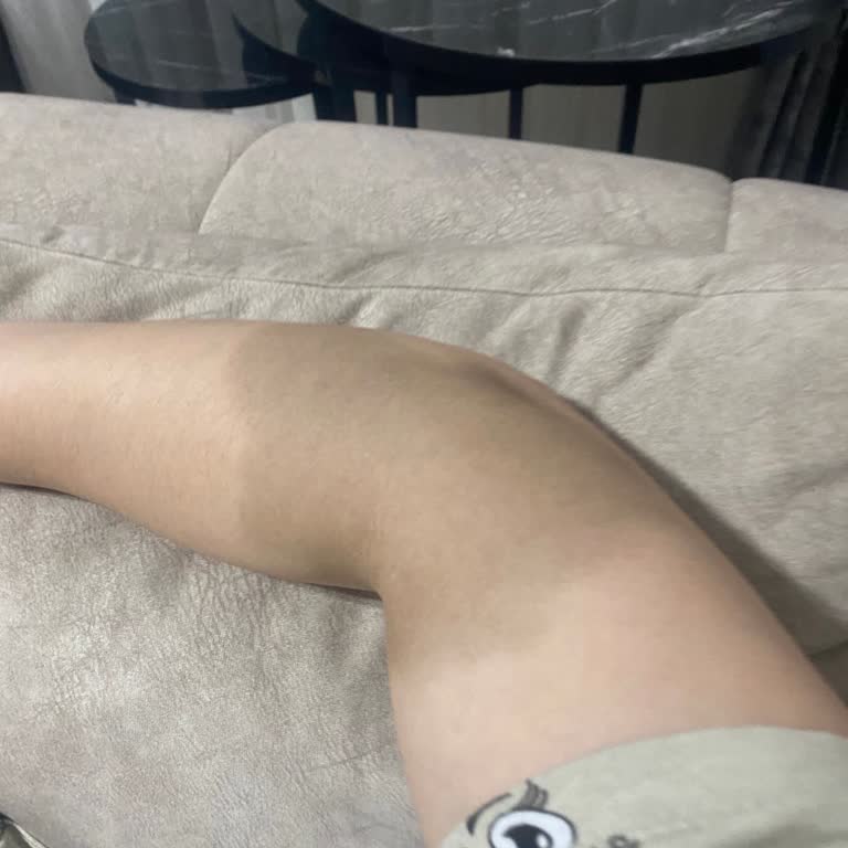 Okan Üniversitesi Hastanesi'nde Serum Lekesi Mağduriyeti