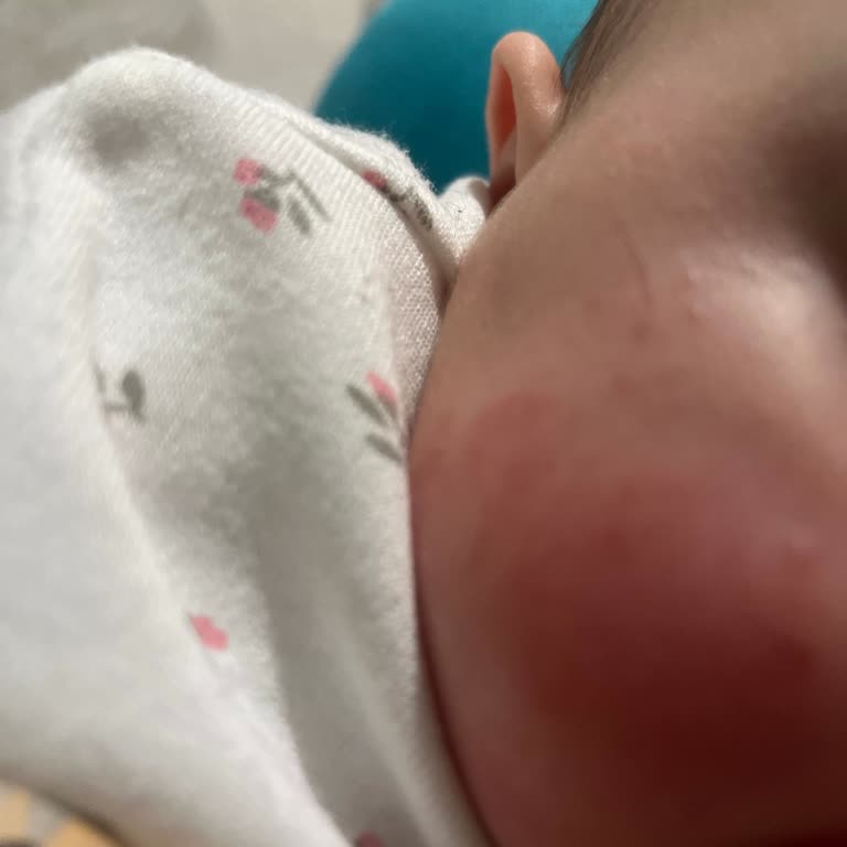 Orzax İlaç Ocean Demir Damlası Bebekte Alerji Yaptı