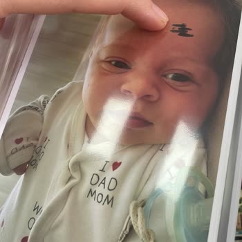 Fotoğraflar Koyu Ve Tanınmaz Halde Geldi