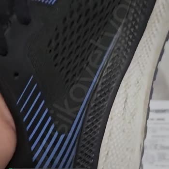 Skechers Tam Bir Pişmanlık, Hayal Kırıklığı, Malının Arkasında Durmuyor!