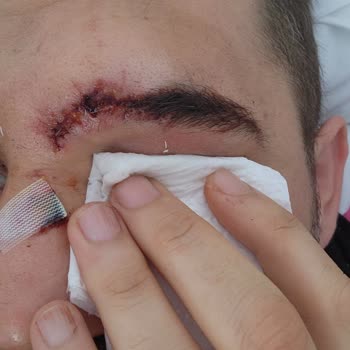 Koru Sigorta'nın Yetersiz Tazminat Teklifi Ve Etik Dışı Davranışlar!