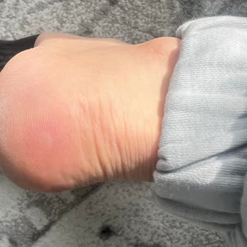 Harley Davidson Botun Sağlık Sorunları Ve Uzun İnceleme Süreci