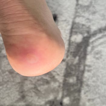 Harley Davidson Botun Sağlık Sorunları Ve Uzun İnceleme Süreci