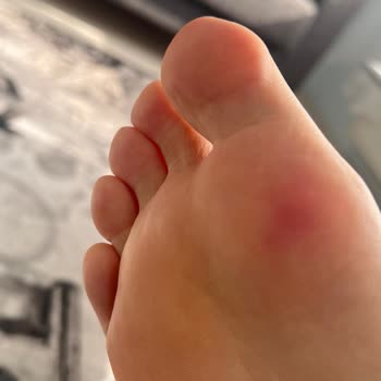 Harley Davidson Botun Sağlık Sorunları Ve Uzun İnceleme Süreci