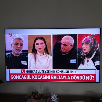 Televizyon Servisinde Yaşanan Sorunlar