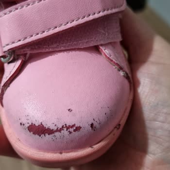 Vicco Bebek Ayakkabısında Kalitesizlik Ve Müşteri Hizmetleri Sorunu!
