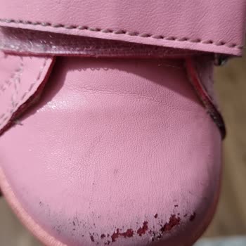 Vicco Bebek Ayakkabısında Kalitesizlik Ve Müşteri Hizmetleri Sorunu!