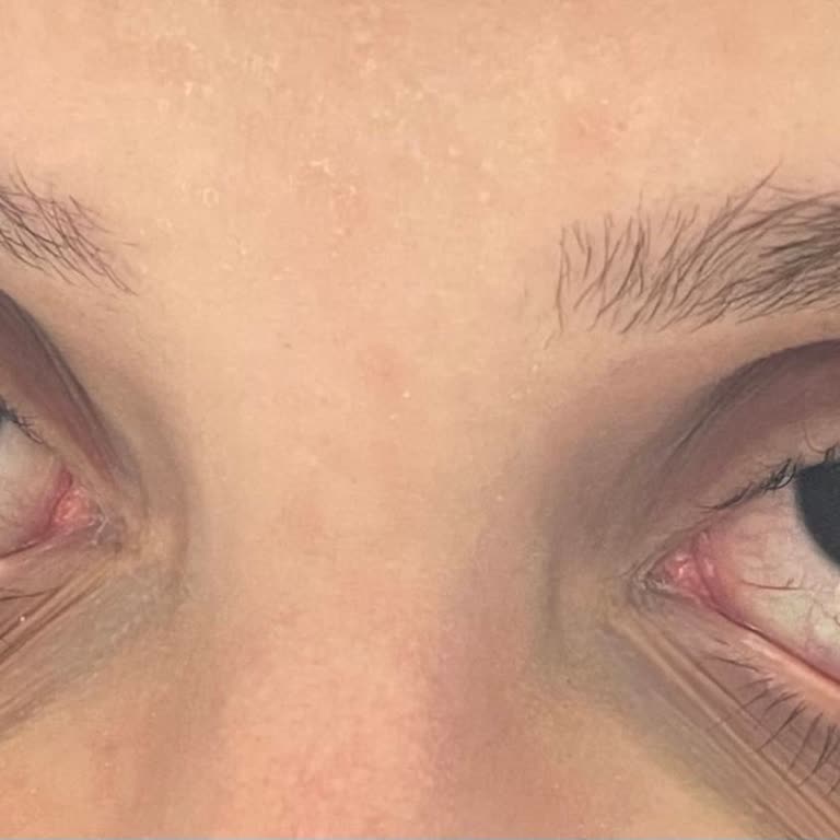 Aris Güzellik Merkezleri İpek Kirpik Fiyaskosu