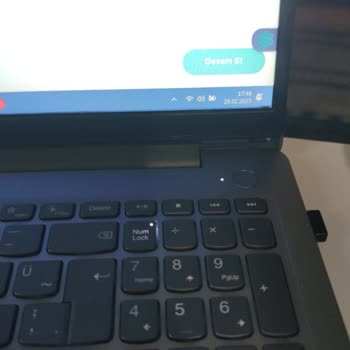 Lenovo Teknik Servis Sorunu Ve Eksik Parça