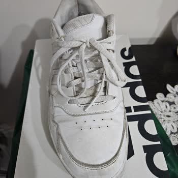 Adidas Ayakkabının Acı Veren Sürprizi!