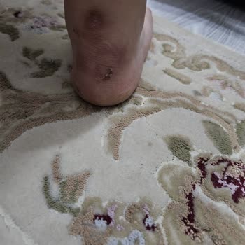 Adidas Ayakkabının Acı Veren Sürprizi!