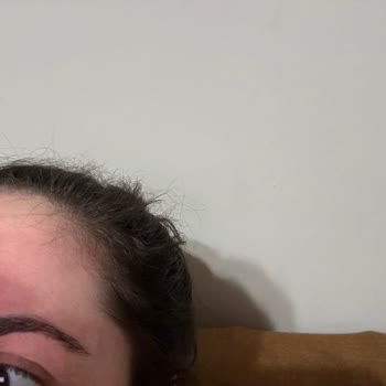 Kaş Alma Hizmetinde Hayal Kırıklığı