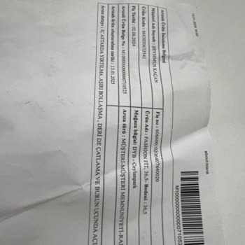 Skechers Ayakkabıda Kalite Sorunu Ve Mağaza İlgisizliği