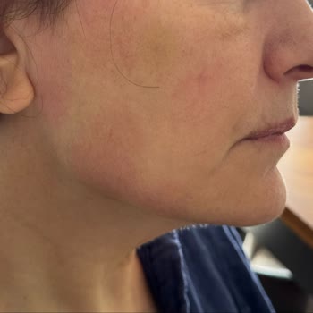 Dr. Önder Kanat Şikayetçiyim