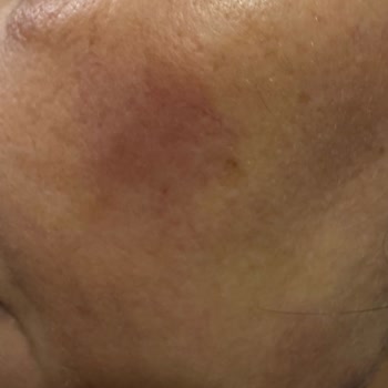 Dr. Önder Kanat Şikayetçiyim