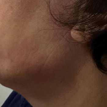 Dr. Önder Kanat Şikayetçiyim