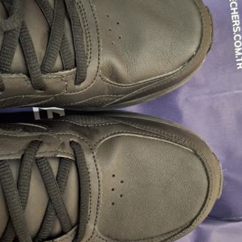 Ayakkabıda Deformasyon Ve İade Süreci Sorunu