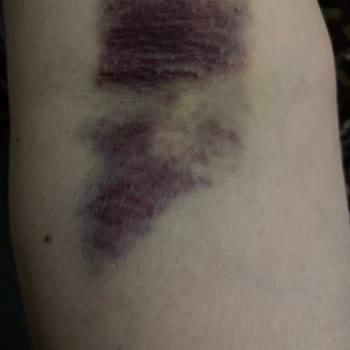 Bozyaka Eğitim Araştırma Hastanesi İletişim Ve İlgi Eksikliği