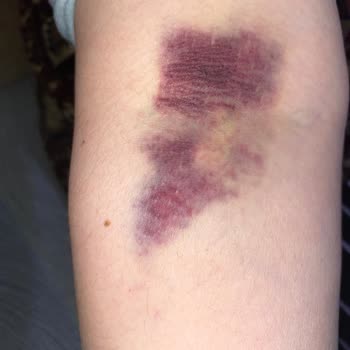 Bozyaka Eğitim Araştırma Hastanesi İletişim Ve İlgi Eksikliği