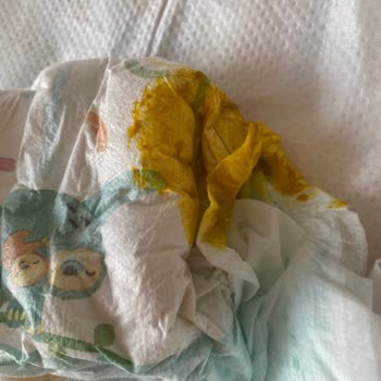 Pampers Bezlerinde Sızdırma Sorunu
