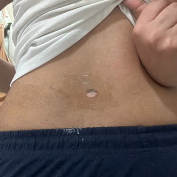 Hande Akgün Beauty Studio Lazer Epilasyonda Güvenlik Sorunları Ve İade Problemi!