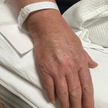 Konya Başkent Hastanesi Yaşanan Hemşire Hataları Ve İletişim Sorunları