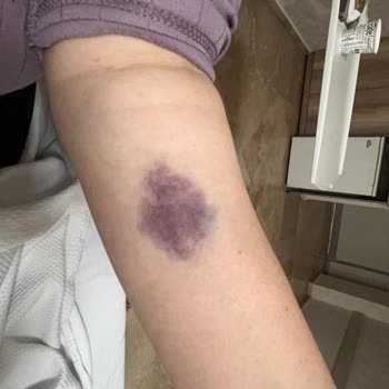 Konya Başkent Hastanesi Yaşanan Hemşire Hataları Ve İletişim Sorunları