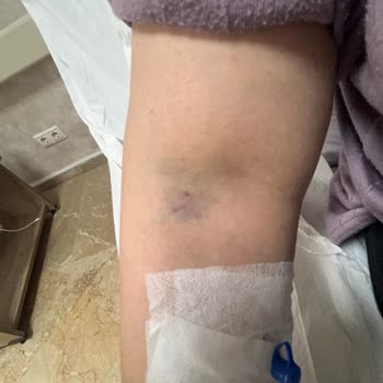 Konya Başkent Hastanesi Yaşanan Hemşire Hataları Ve İletişim Sorunları