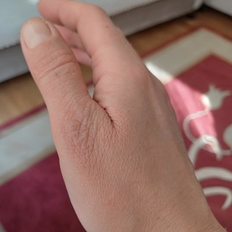 Neutrogena Yüz Kremi Hayal Kırıklığı Yarattı