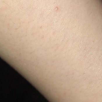 Nureste Estetik Lazer Epilasyon Hizmetinde Memnuniyetsizlik Ve Randevu Sorunları