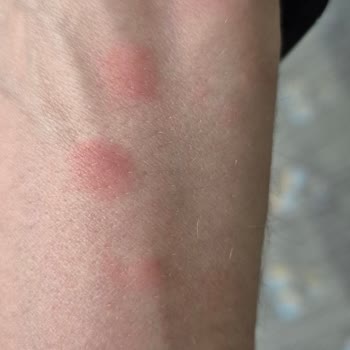 Yataş'tan Aldığım Baza Böcek Yuvası Çıktı Maddi Ve Manevi Zarar Büyük