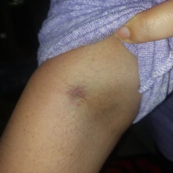 Görüntüleme Merkezinde Yaşanan Sorunlar Ve İlgisizlik